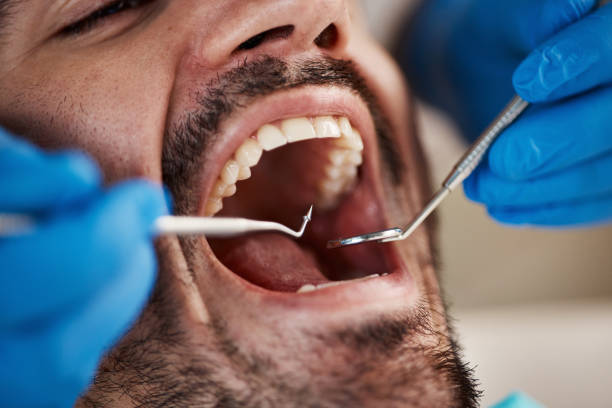 Best Urgent Care for Lost Fillings or Crowns in Washington Mills, NY